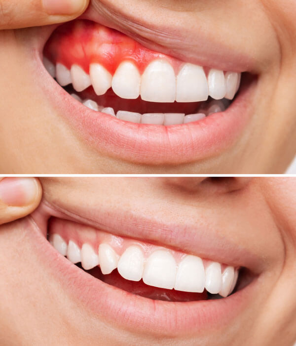 خدمات Tooth Guard للأسنان